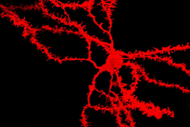 Confocal image of a red-colored mouse neuron with dendritic branches and spines on a black background