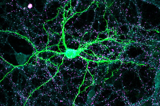 Microscopic image of a green-colored mouse cortical neuron with white and purple GABAergic synapse markers