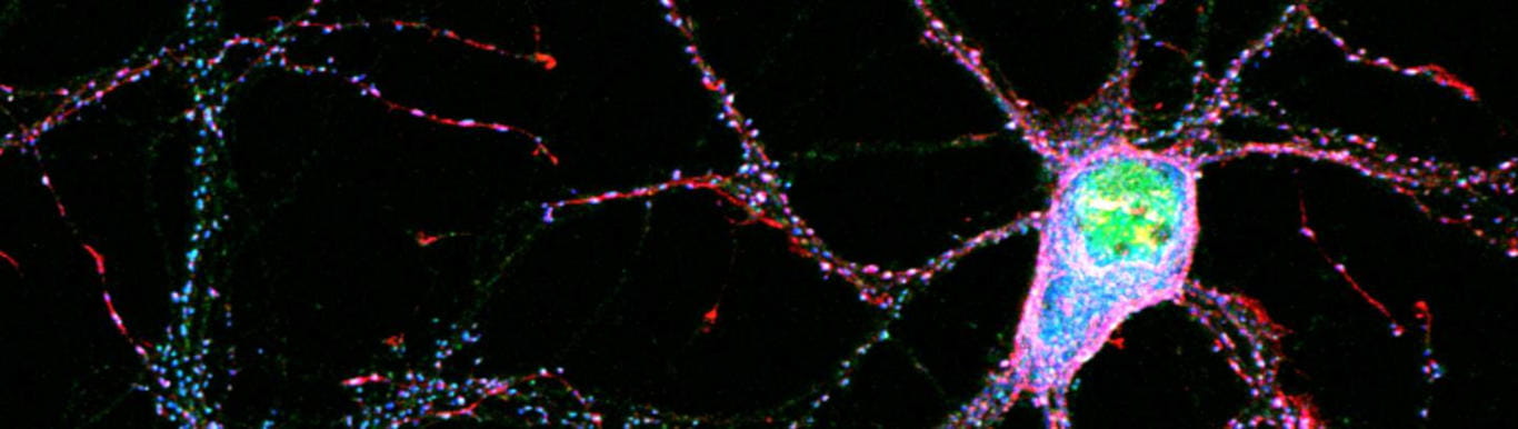 Digital image of nerve cells