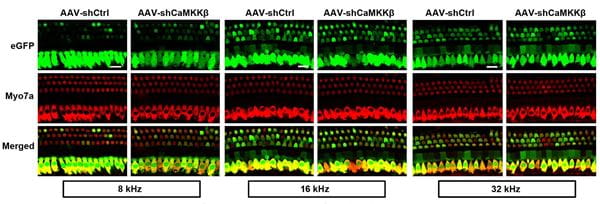 Application of shCaMKKβ, short-hairpin RNA specific to inhibition of CaMKKβ, via adeno-associated virus (AAV) vector transfection significantly reduces CaMKKβ expression in the inner ear. 