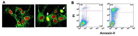 ATP-depletion agent oligomycin induces Endo G nuclear translocation in HEI-OC1 cells. 