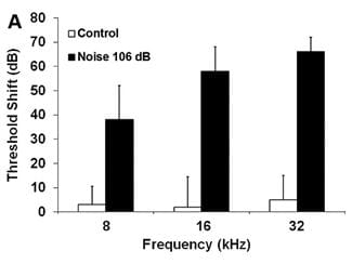 The bar graph represents the permanent NIHL in 3-month-old male CBA/J mice resulting two weeks after exposure to 2–20 kHz broadband noise (BBN) at 106 dB SPL for two hours.