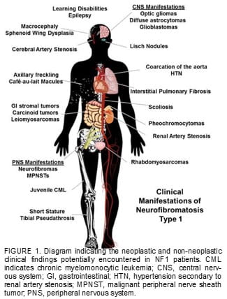 Clinical Manifestations of Neurofibromatosis