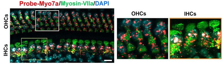 Fluorescence in-situ hybridization (FISH) of Myosin7a mRNA. 