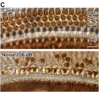 The representative images illustrate hair cell losses in the middle region (3 mm from apex) two weeks after exposure to 106 dB SPL 2–20 kHz BBN.