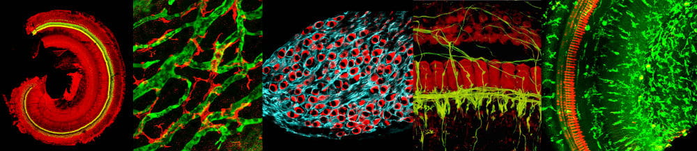 Figures for Cellular and Molecular Mechanisms of Sensorineural Hearing Loss