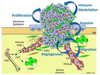 Figure 1. Potential mechanisms by which HSC-derived CFPs, CAFs and CAAs promote tumor growth and metastasis.
