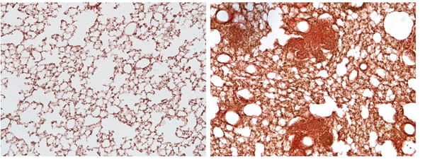 Figure 6. Silica induces fibrosis in mouse lungs