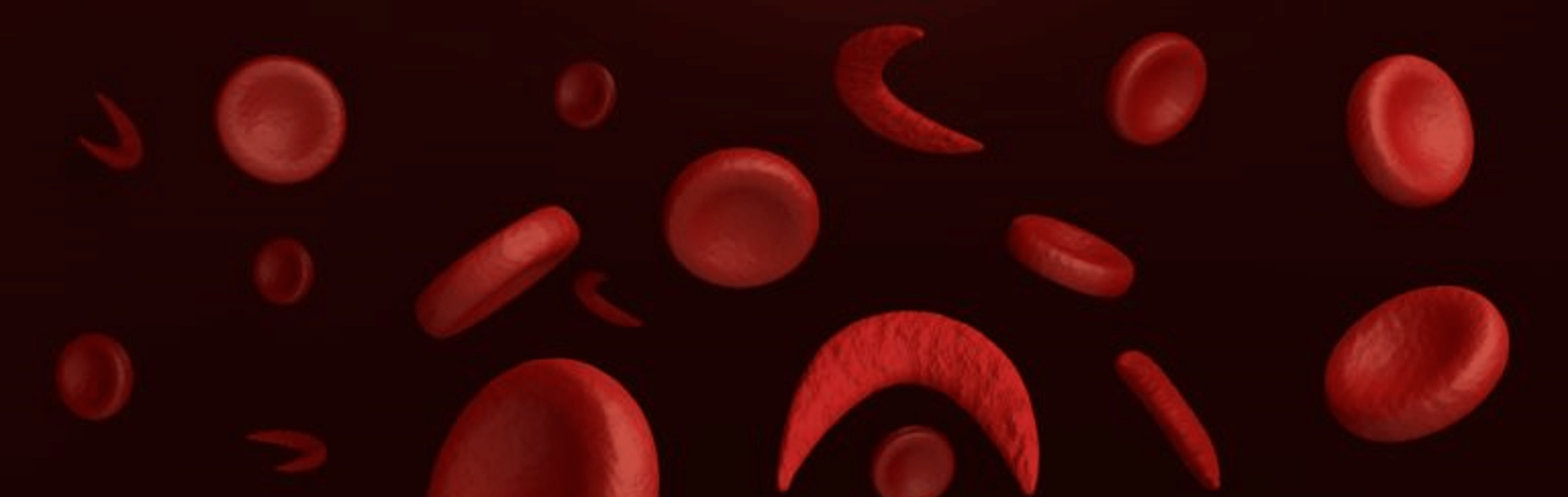 Sickle Cell Disease and ICU