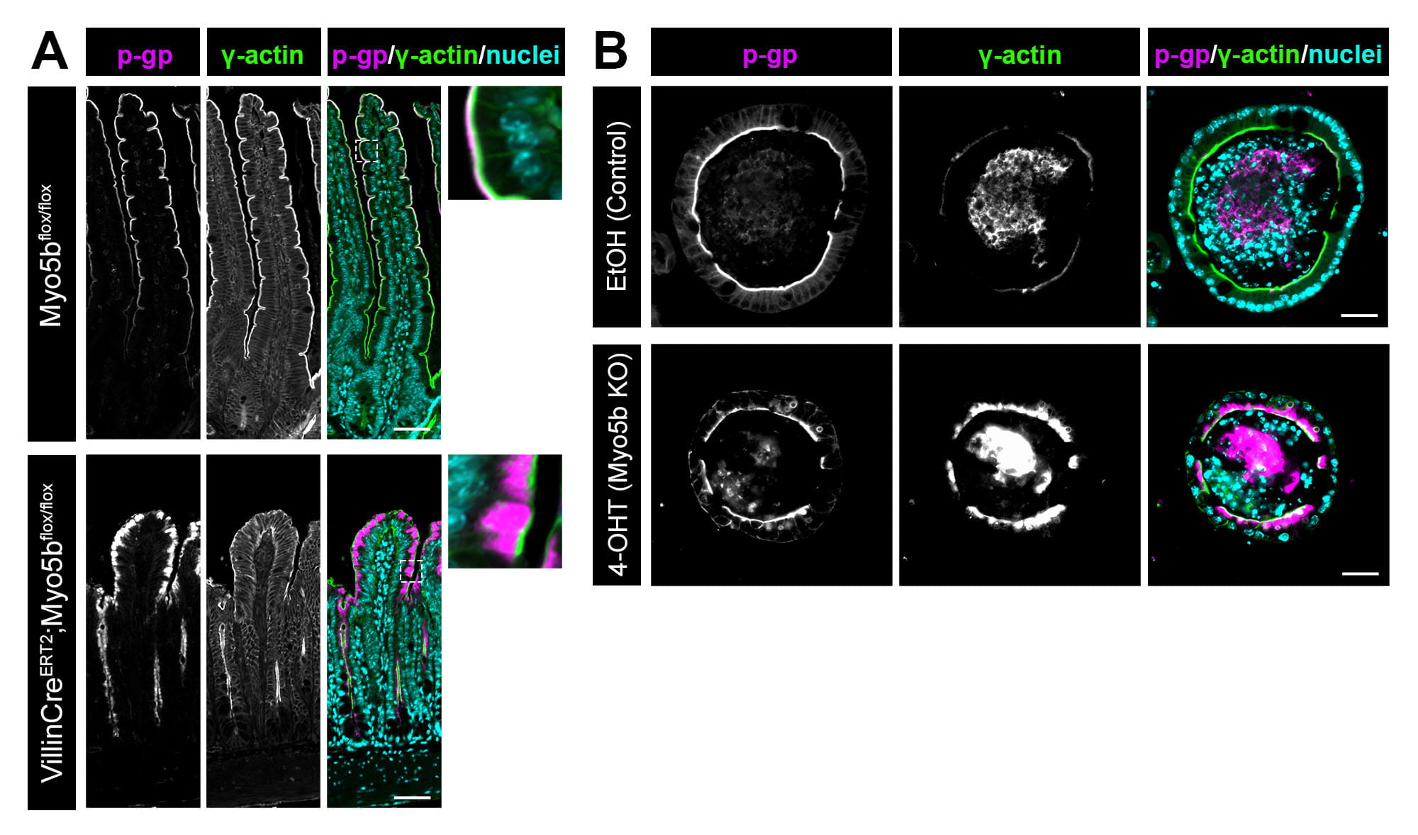 Expression of Myosin Vb in intestinal villi from control and floxed mice