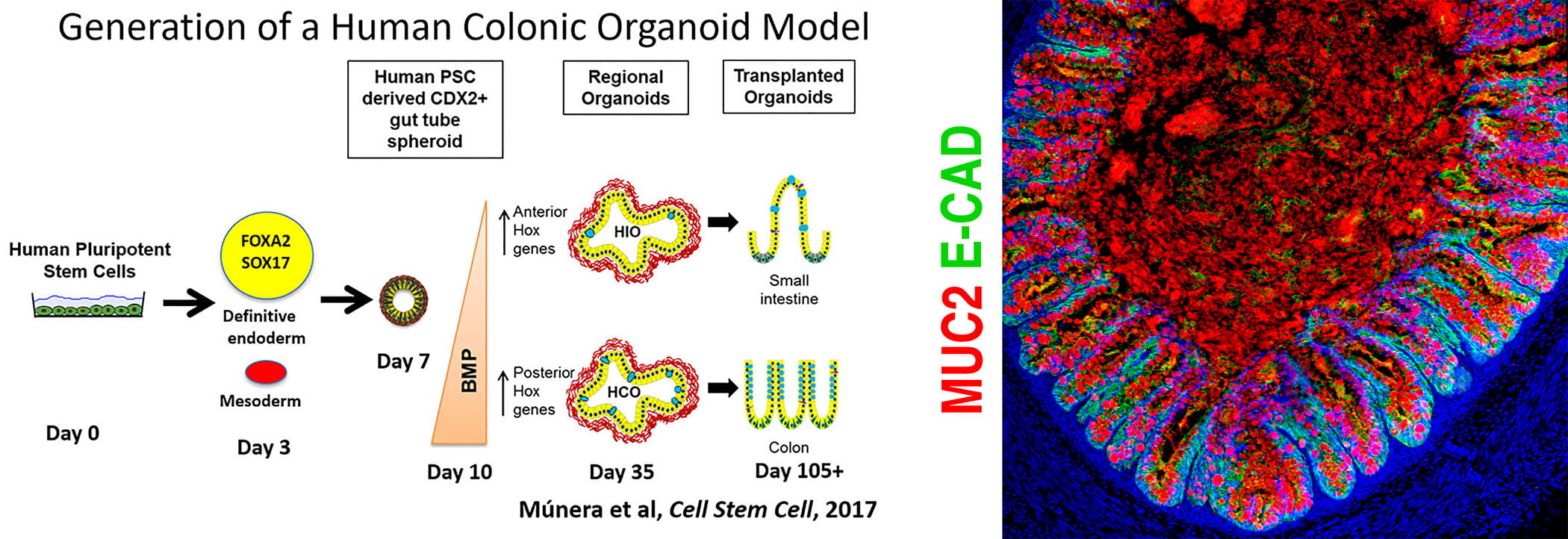 Schema of human organoid colonic model