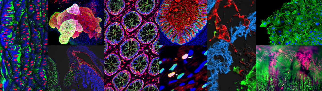 Various immunofluorscennt images obtained by the department of regerative medicine and cell biology