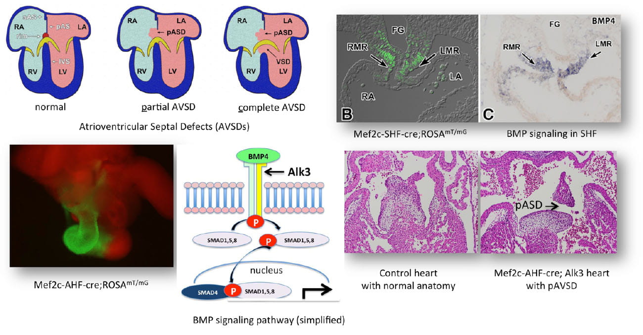 Development of the atrioventricular valves showing expression of bone morphogenic protein signaling