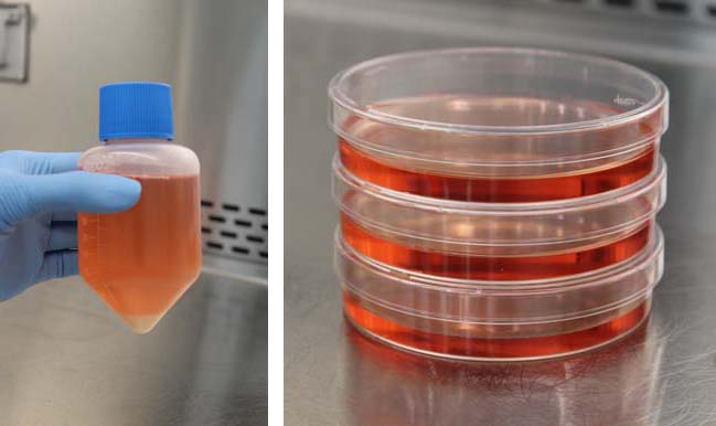 The CCT processes cells during the islet cell transplantation process