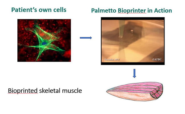 tissue engineering of skeletal muscle