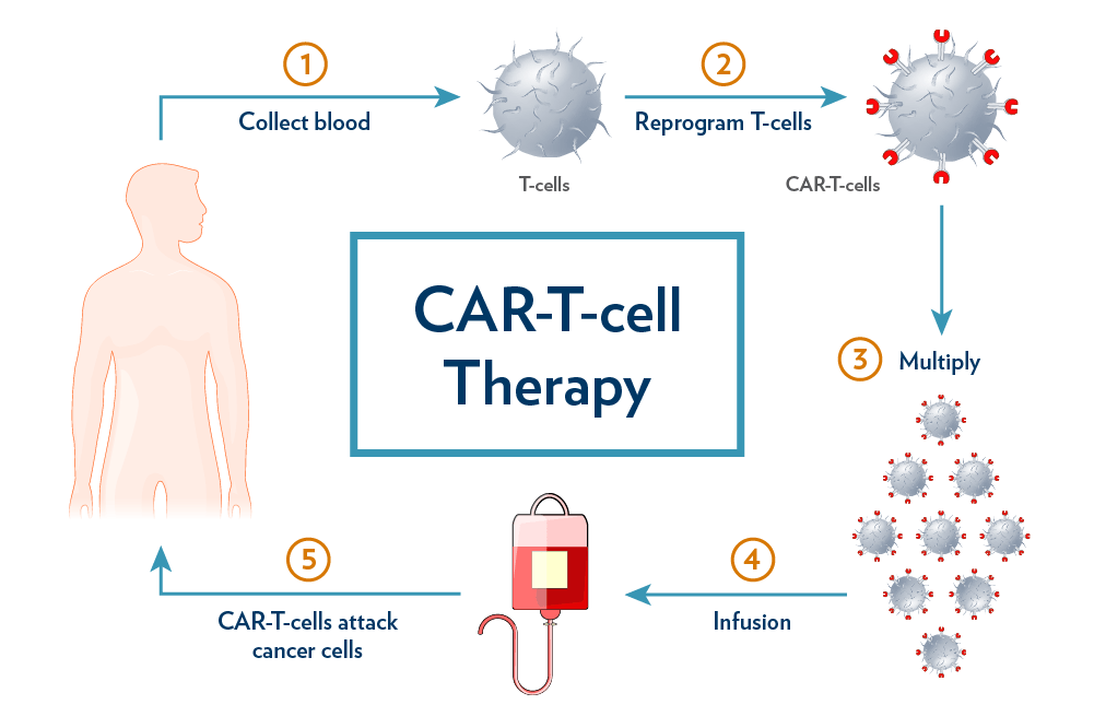 Car-T-cell therapy process