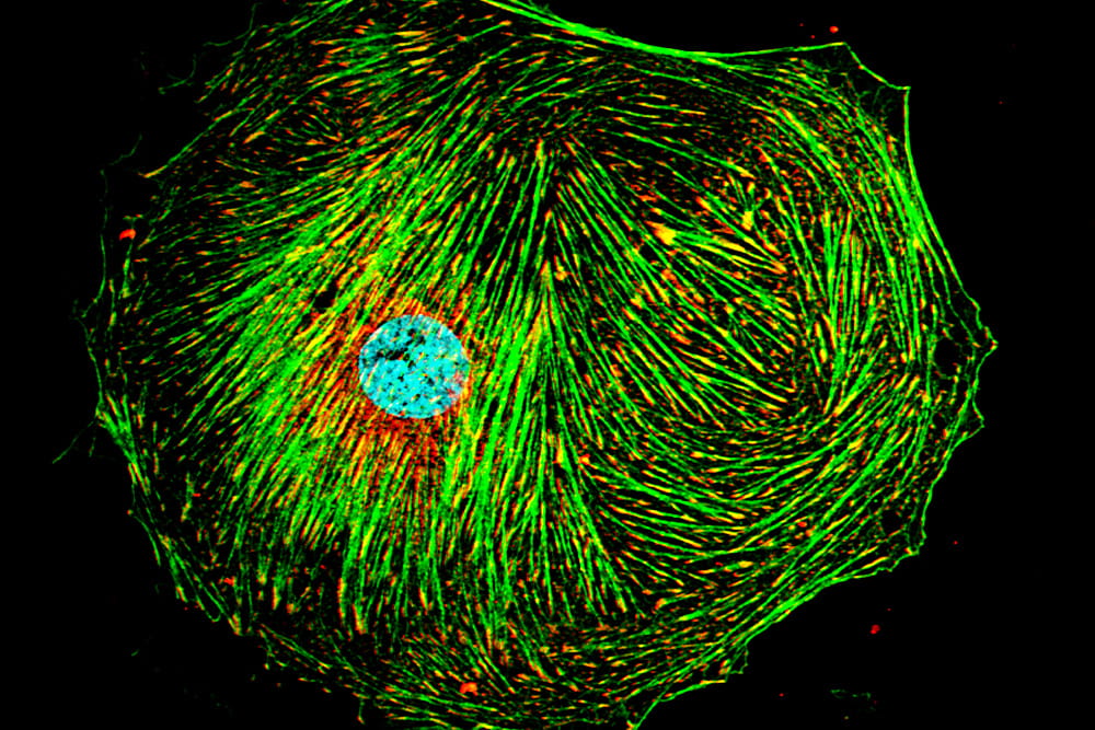 Stellate Cell Focal Adhesions and Cytoskeleton. Image courtesy of Dr. Don Rockey, rights reserved.