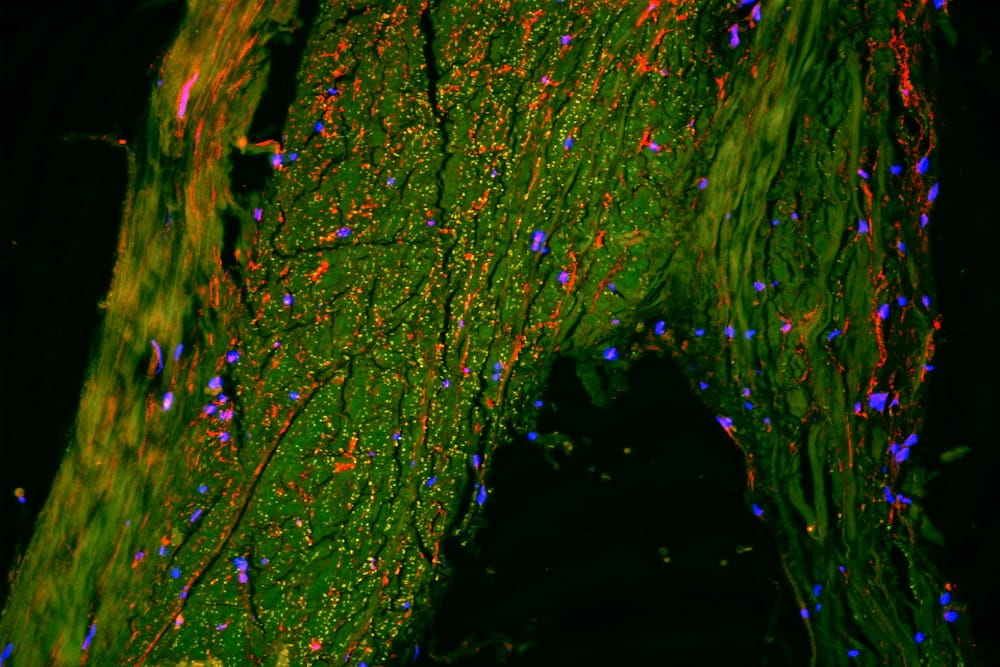 Microscope image showing lymphatic vessels (red) in the brain’s outer protective layer, called the dura. These vessels form a rich and complex network that helps drain waste from the brain, revealing the diversity and direction of lymphatic flow within the meninges. Image courtesy of Dr. Onder Albayram.